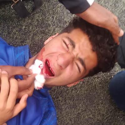 خناقة شوارع داخل نادي الزمالك.. وإصابة لاعب غزل المحلة بارتجاج في المخ ومحضر في القسم!